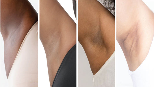 Armpit Pigmentation